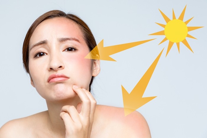 kem chống nắng loại nào tốt nhất